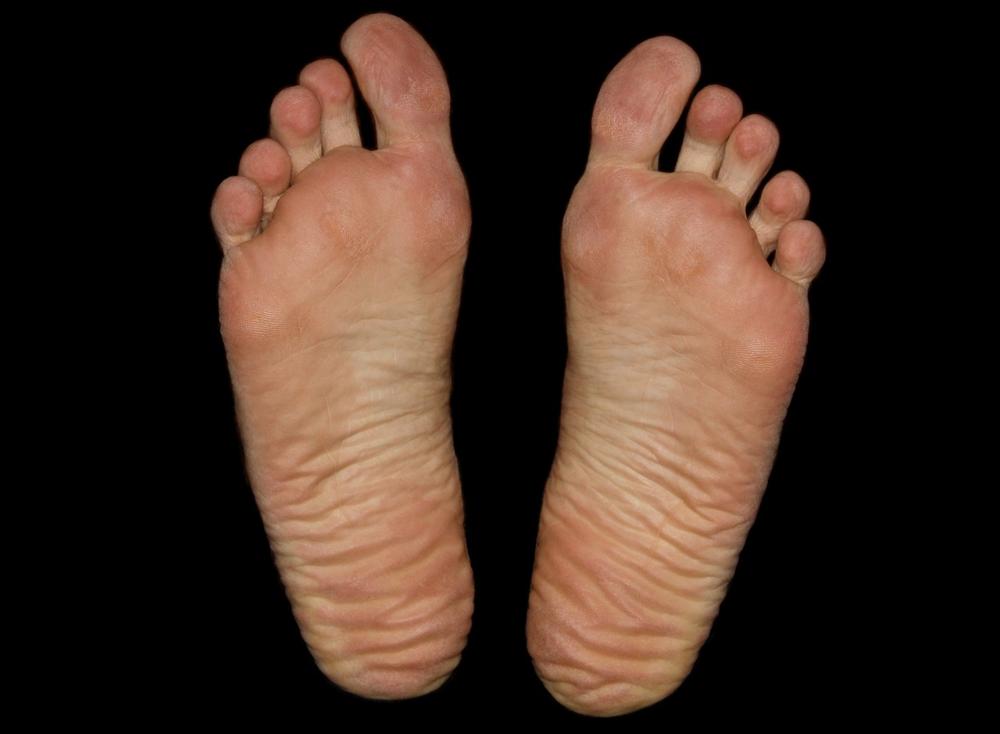 foot pain
